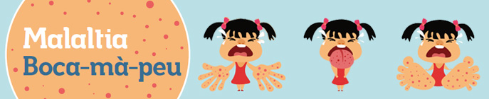 Malaltia Boca-mà-peu