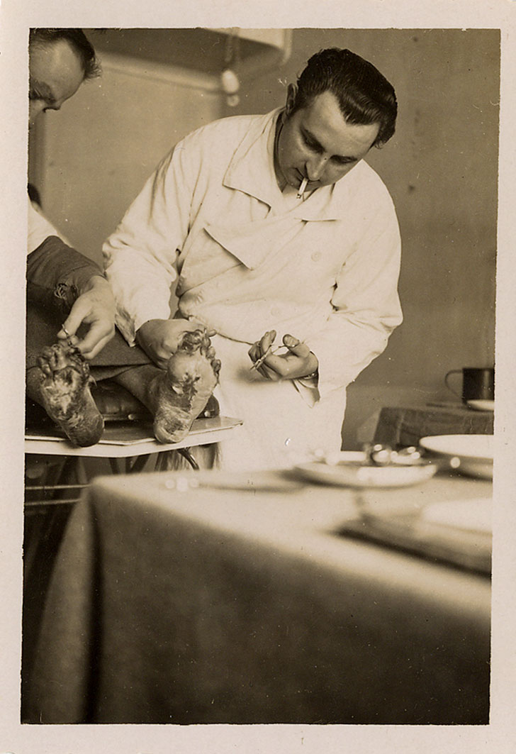 FSG_0007: Un metge curant els peus congelats d’un refugiat espanyol